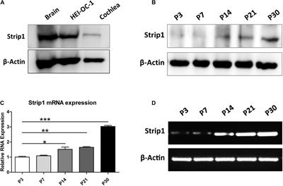 Characterization of Strip1 Expression in Mouse Cochlear Hair Cells